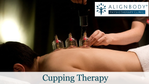 Dry Cupping Therapy