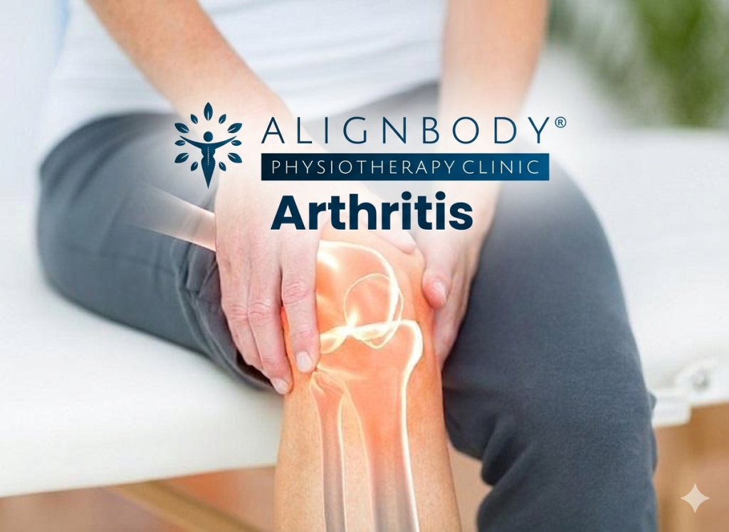 Arthritis Treatment – What More You Need To Know About This?