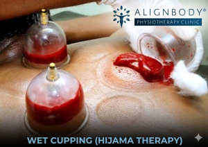 Wet Cupping (Hijama Therapy)