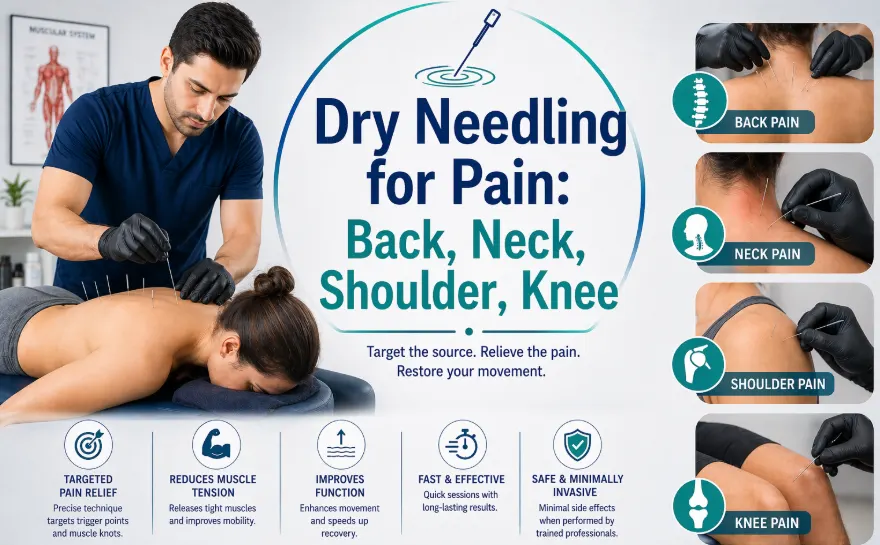 Dry Needling for Pain: Back, Neck, Shoulder, Knee, Sciatica, SI Joint
