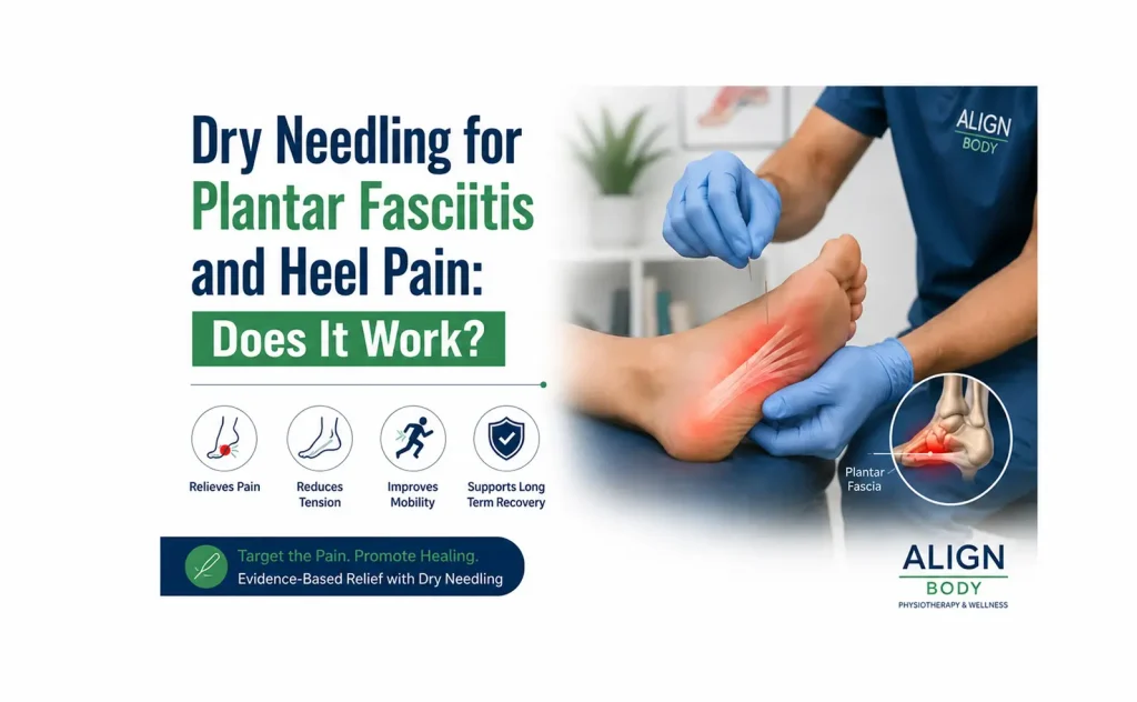 Dry Needling for Plantar Fasciitis and Heel Pain: Does It Work?
