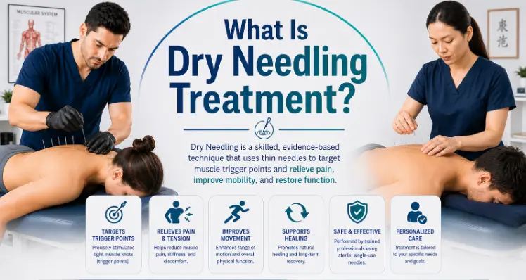 What Is Dry Needling Treatment?